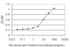 IHC-plus™ Monoclonal Mouse anti-Human FOXO3 / FOXO3A Antibody (clone 2H2, IHC, IF, WB)