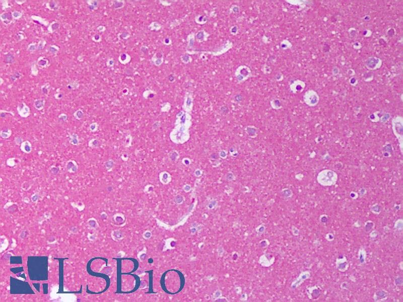 IHC-plus™ NRG1 / Heregulin / Neuregulin Antibody