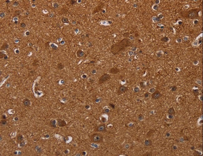 Polyclonal Rabbit anti-Human CYBB / NOX2 / gp91phox Antibody (IHC)