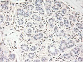 VEGFA / VEGF Antibody (clone OTI4E3)
