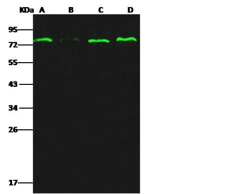 Monoclonal Rabbit anti-Human ER Alpha / Estrogen Receptor Antibody (clone 107, Preservative Free, WB)