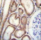 CLEC3B / Tetranectin Antibody (aa95-122)
