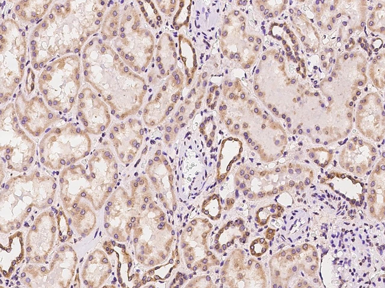 Polyclonal Rabbit anti-Human WWOX Antibody (IHC, IF, WB)