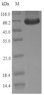 Human POU5F1 / OCT4 Protein (Recombinant 6His-B2M, N-terminus)