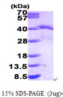 Human EIF2S1 Protein (Recombinant His)