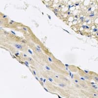 KCTD15 Antibody