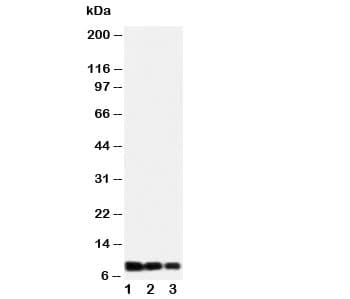 Polyclonal Rabbit anti-Human IL8 / Interleukin 8 Antibody (aa77-95, IHC, WB)