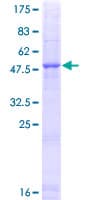 Human CELA1 / Pancreatic Elastase 1 Protein (Recombinant GST)