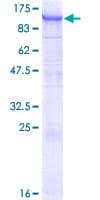 Human FBXO42 / JFK Protein (Recombinant GST)