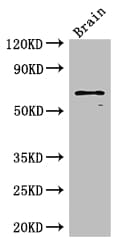 SLC6A3 / Dopamine Transporter Antibody