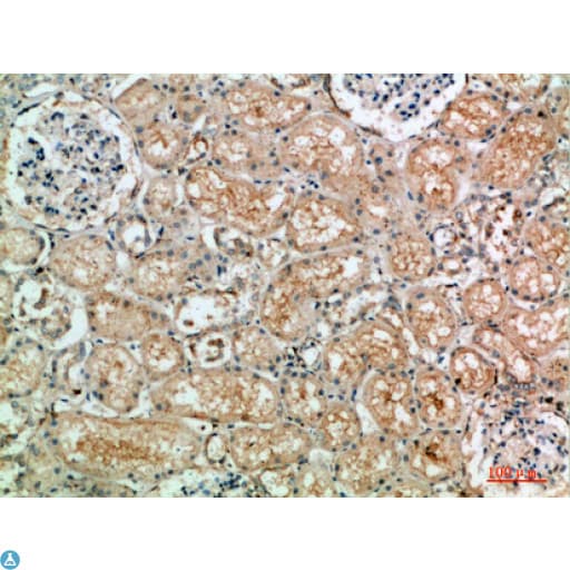 TLE1 / TLE 1 Antibody