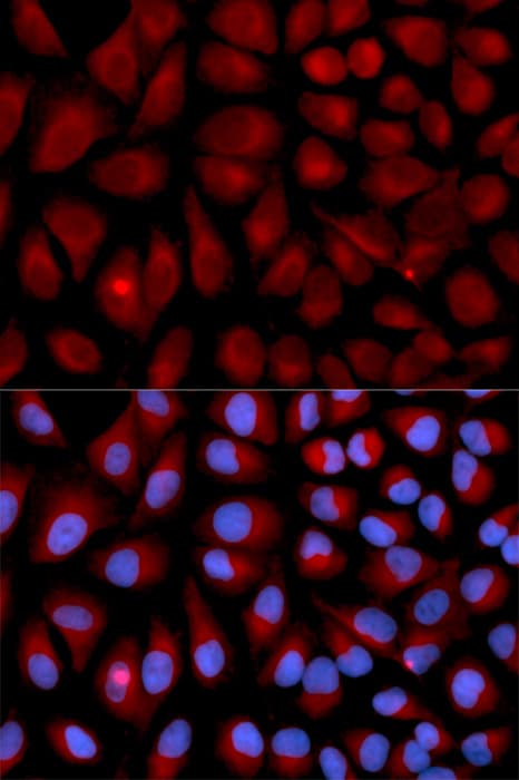 Vimentin Antibody