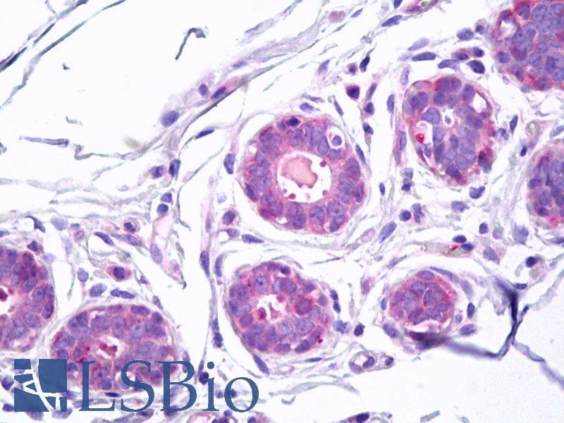 IHC-plus™ TGM5 / Transglutaminase 5 Antibody