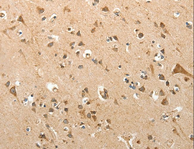 SLC12A4 / KCC1 Antibody