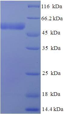 Human IDH3G Protein (Recombinant His-SUMO)