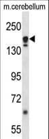 ATG2A Antibody (aa702-731)