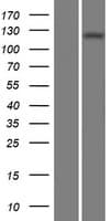 ADCY1 / Adenylate Cyclase 1 Protein (Over-Expression Lysate Myc-DDK (Flag))