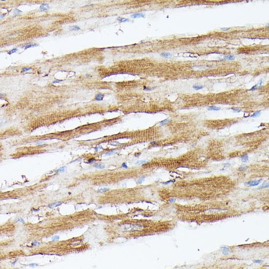 Polyclonal Rabbit anti-Human NBP / NUBP1 Antibody (IHC)
