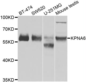 Polyclonal Rabbit anti-Human KPNA6 Antibody (IHC, WB)