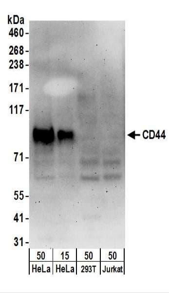 IHC-plus™ Polyclonal Rabbit anti-Human CD44 Antibody (aa692-742, IHC, WB)