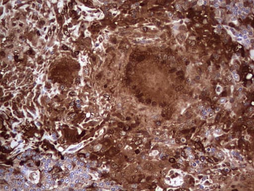 LGALS3 / Galectin 3 Antibody (clone OTI2F1)