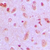 ZDHHC9 Antibody (C-Terminus)