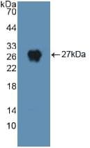 DNM2 / Dynamin-2 Antibody (aa533-731)