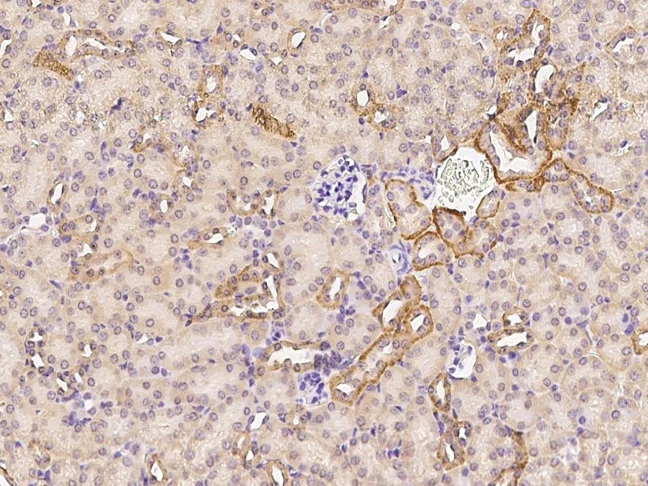 CSF1R / CD115 / FMS Antibody (Preservative Free)