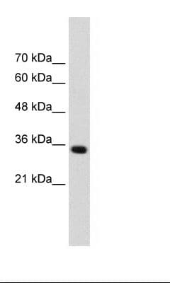 ADAMTS4 Antibody (aa101-150)
