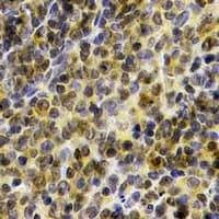 BTK Antibody (Internal)