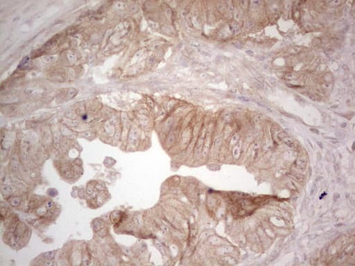 ERBB3 / HER3 Antibody (clone OTI1A5)