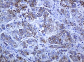 KRT5 / CK5 / Cytokeratin 5 Antibody (aa1-273, clone OTI1E7)