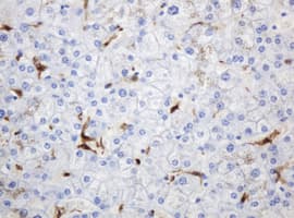 TP / Thymidine Phosphorylase Antibody (aa311-482, clone 7A6, Carrier-free)