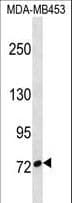 Polyclonal Rabbit anti-Human CUX1 / CASP Antibody (aa640-666, WB)