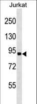Polyclonal Rabbit anti-Human RNF10 Antibody (aa178-206, WB)