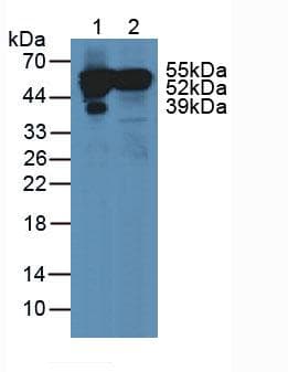 GC / Vitamin D-Binding Protein Antibody (aa395-474)