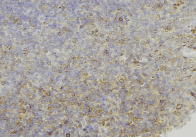 Polyclonal Rabbit anti-Human PMEL / SILV / gp100 Antibody (IHC, IF, WB)