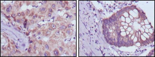 SDR9C1 / BDH1 Antibody (clone 1A5)