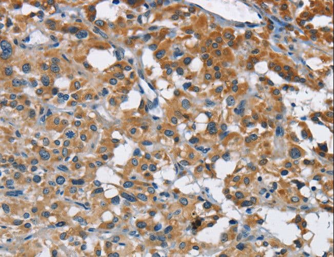 ANKHD1 Antibody