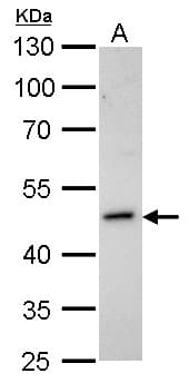 IHC-plus™ HOMER1 / Homer 1 Antibody (aa72-339)