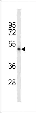 Polyclonal Rabbit anti-Human TPH2 Antibody (aa168-193, IHC, WB)