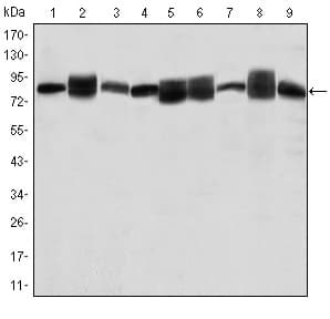 IHC-plus™ Monoclonal Mouse anti-Human HSP90AB1 / HSP90 Alpha B1 Antibody (clone 5G4, aa149-357, IHC, IF, WB)