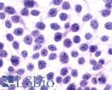 IHC-plus™ GPRC5A / RAI3 Antibody (C-Terminus)