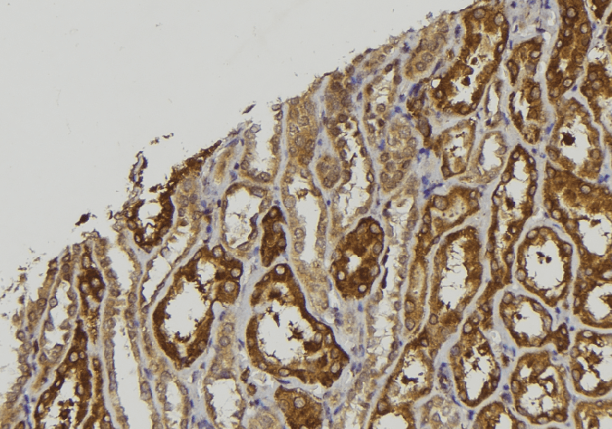 Polyclonal Rabbit anti-Human CPXM2 Antibody (IHC, WB)