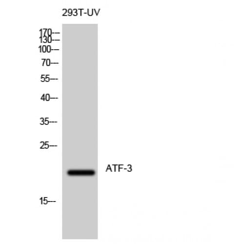 ATF3 Antibody (100-180 aa, C-terminal)