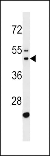 GATSL2 Antibody (aa25-51)