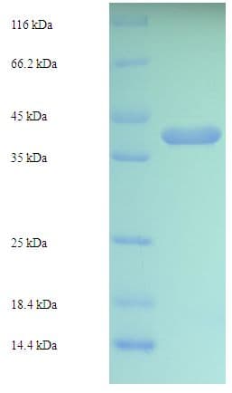 Human RAB5C Protein (Recombinant His-SUMO)