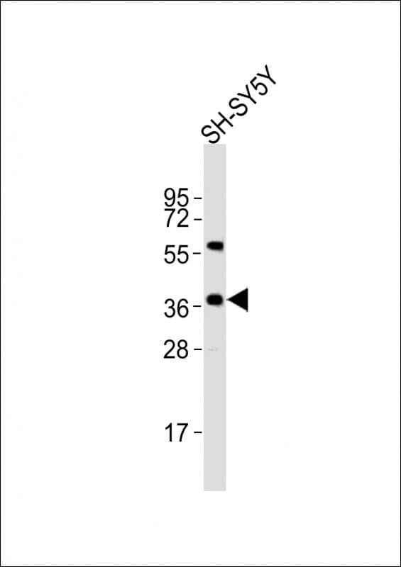 NODAL Antibody