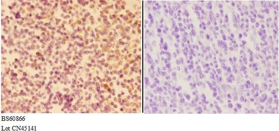 APAF1 / APAF-1 Antibody
