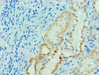 PRMT1 Antibody (aa20-353)